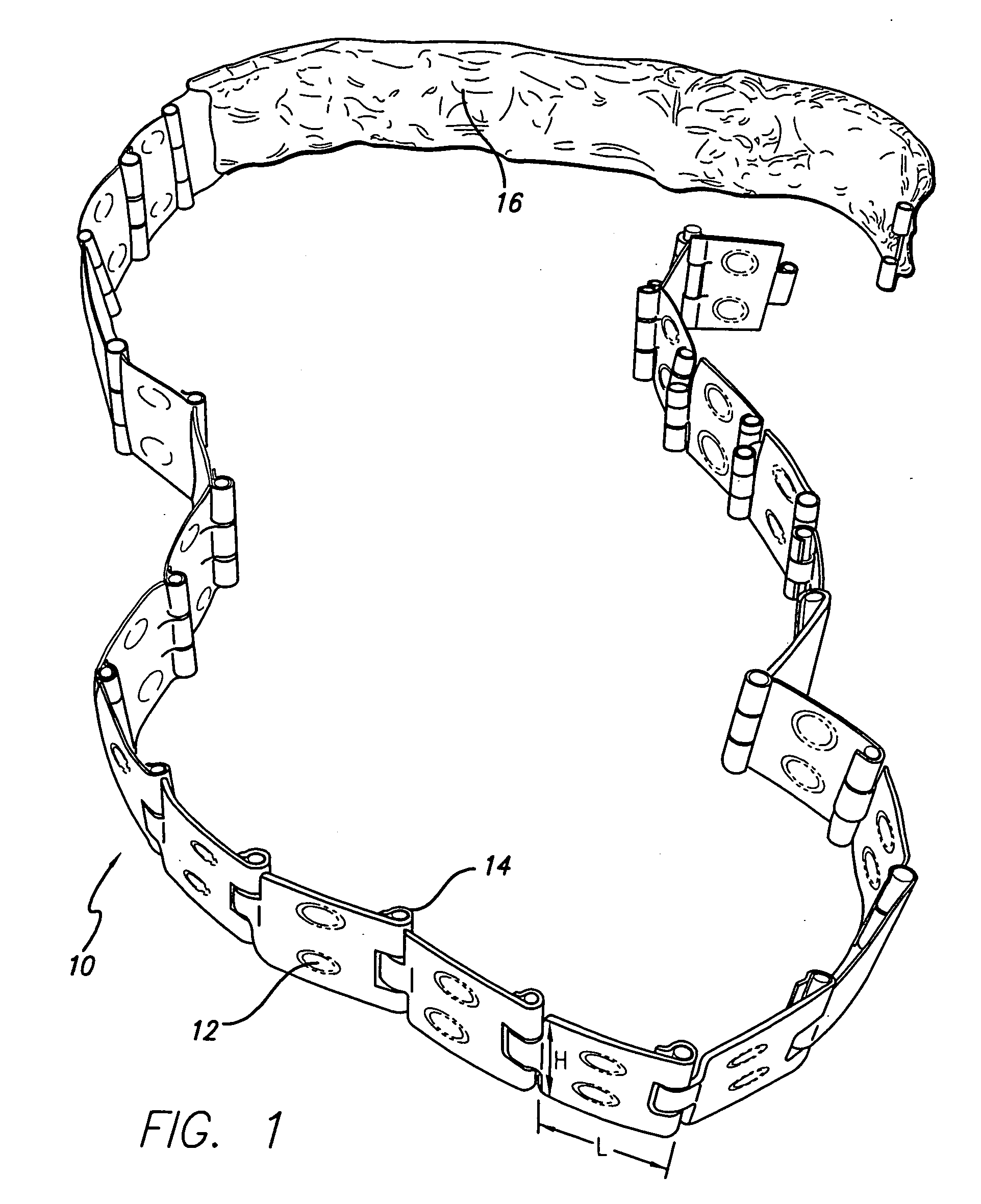 Flexible baking apparatus