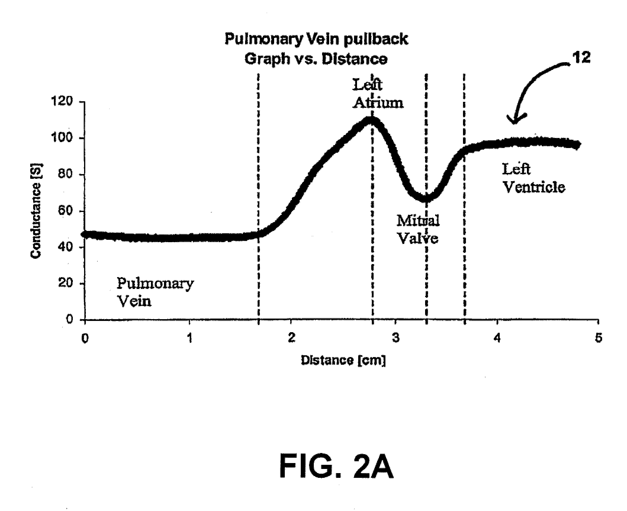 Systems and methods for placing heart leads