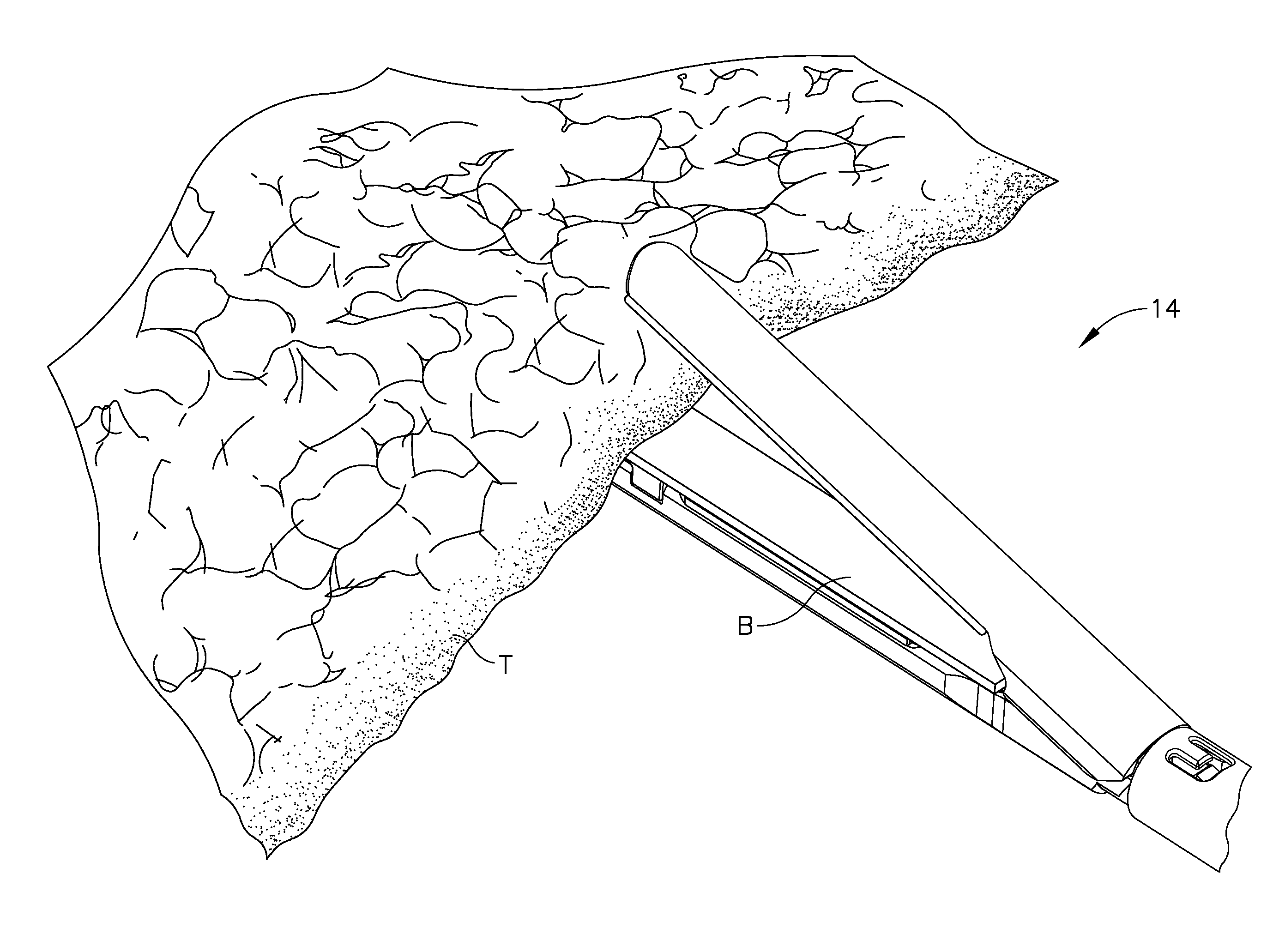 Layer arrangements for surgical staple cartridges