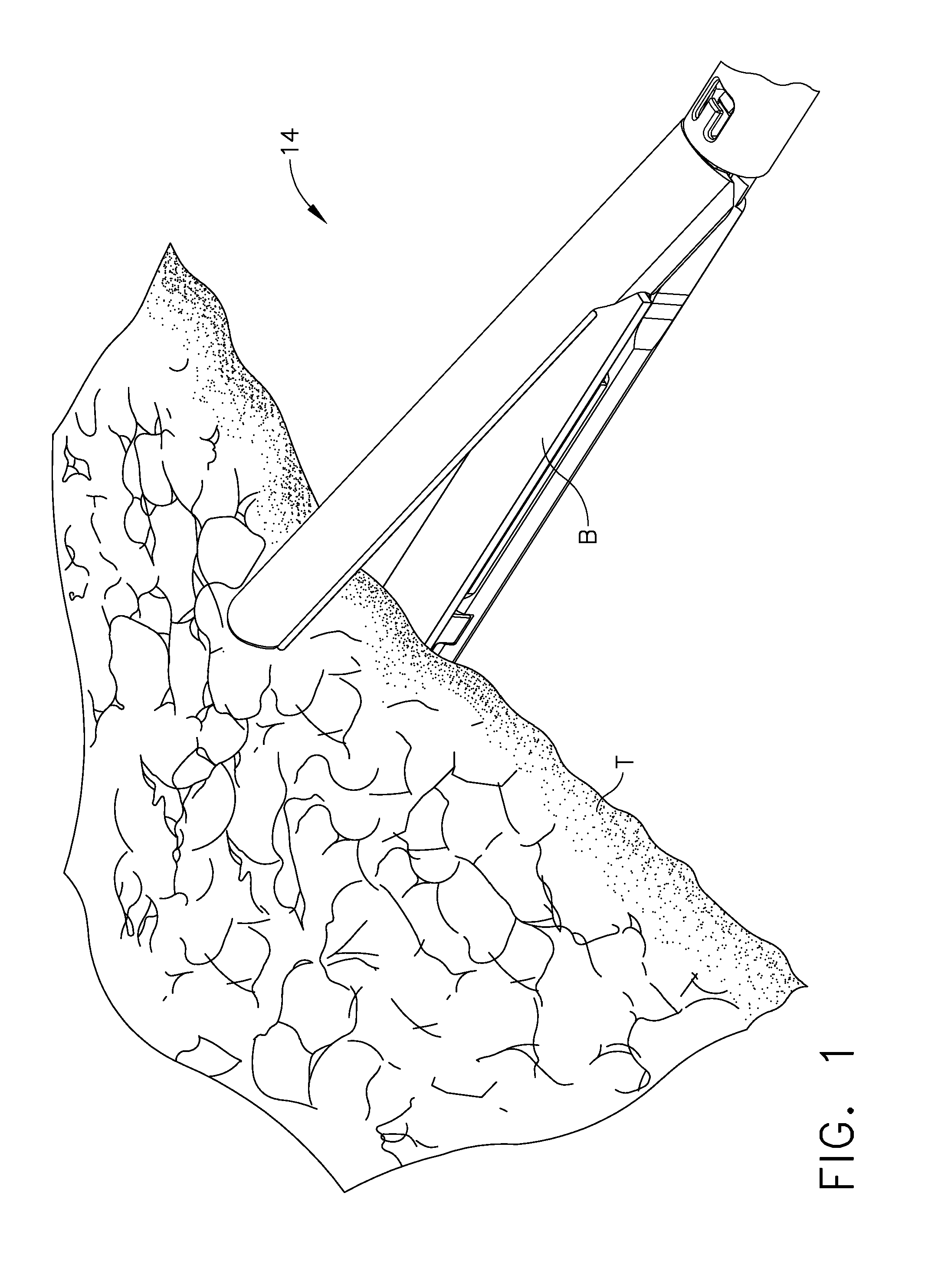 Layer arrangements for surgical staple cartridges