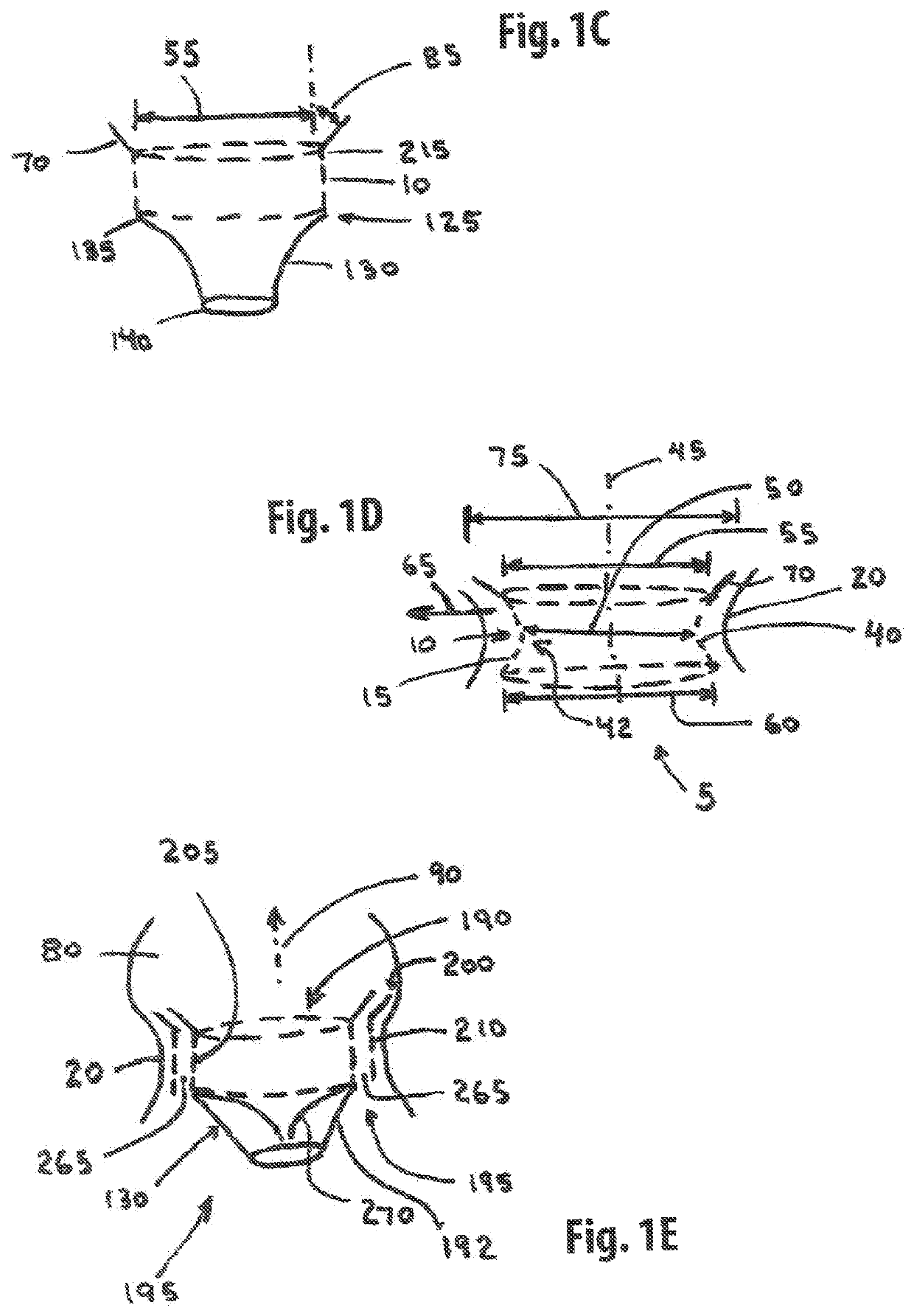 Straddle annular mitral valve