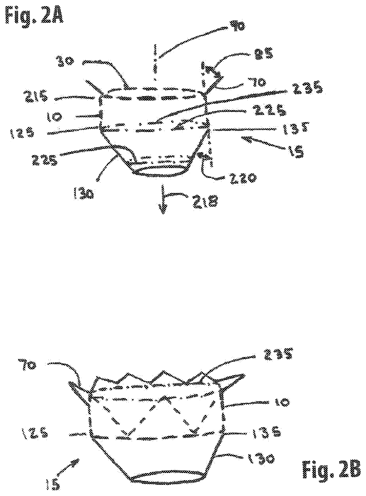 Straddle annular mitral valve