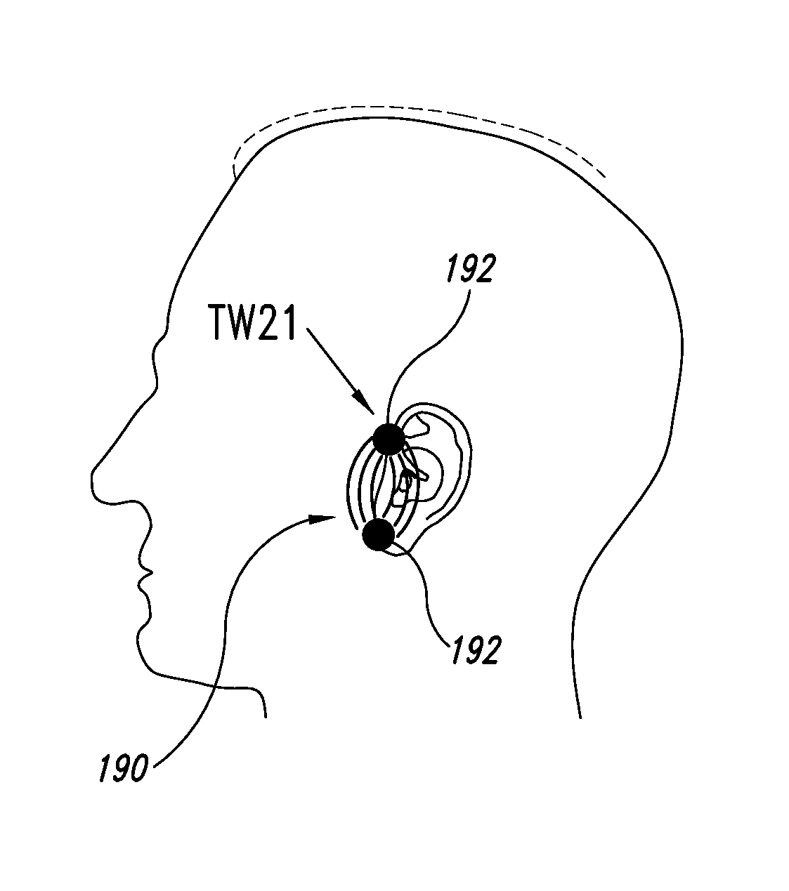 Systems, apparatuses, and methods for providing non-transcranial electrotherapy