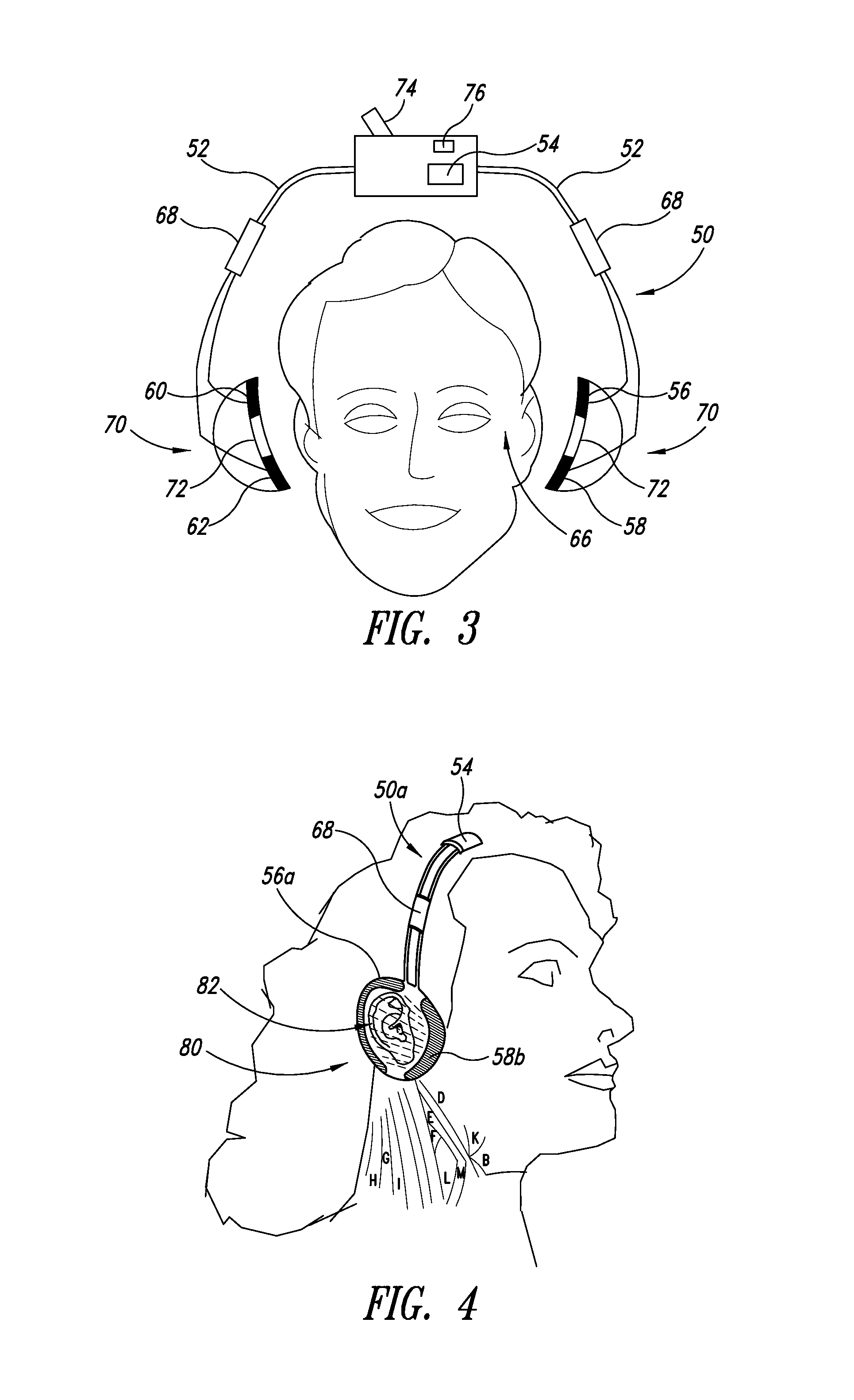 Systems, apparatuses, and methods for providing non-transcranial electrotherapy