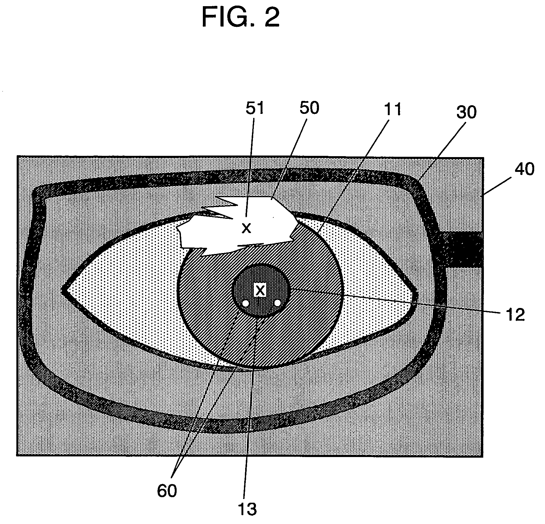 Eye imaging device