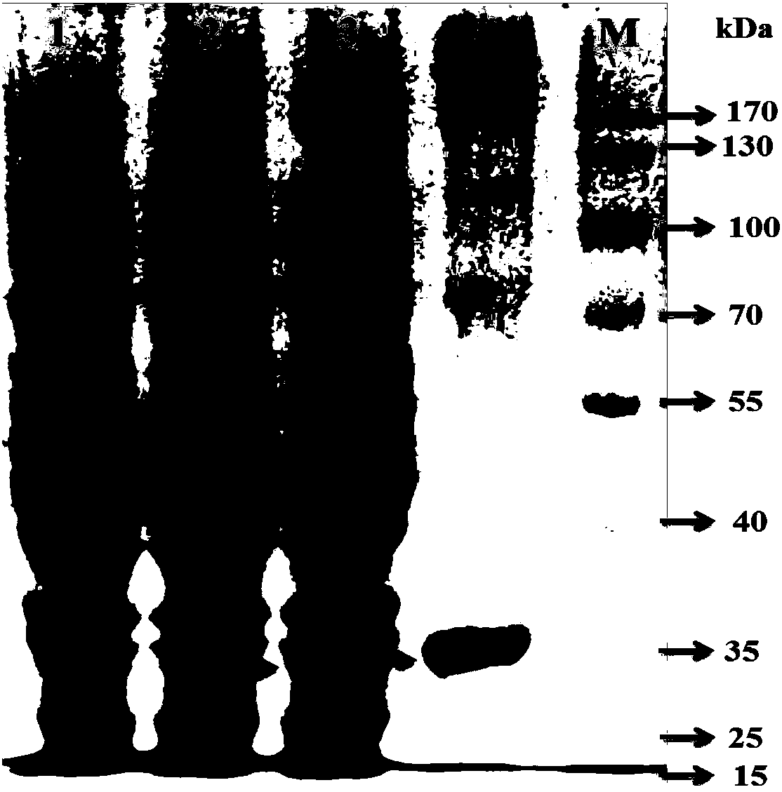 Method for improving yield of lysine through heterogeneous expression of dihydrodipicolinate reductase (DHDPR) in colibacillus