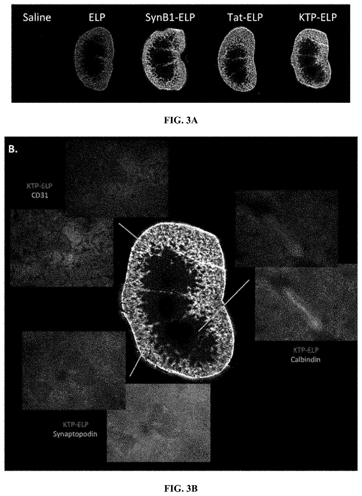 Molecular-Size of Elastin-Like Polypeptide Delivery System for Therapeutics Modulates Intrarenal Deposition and Bioavailability