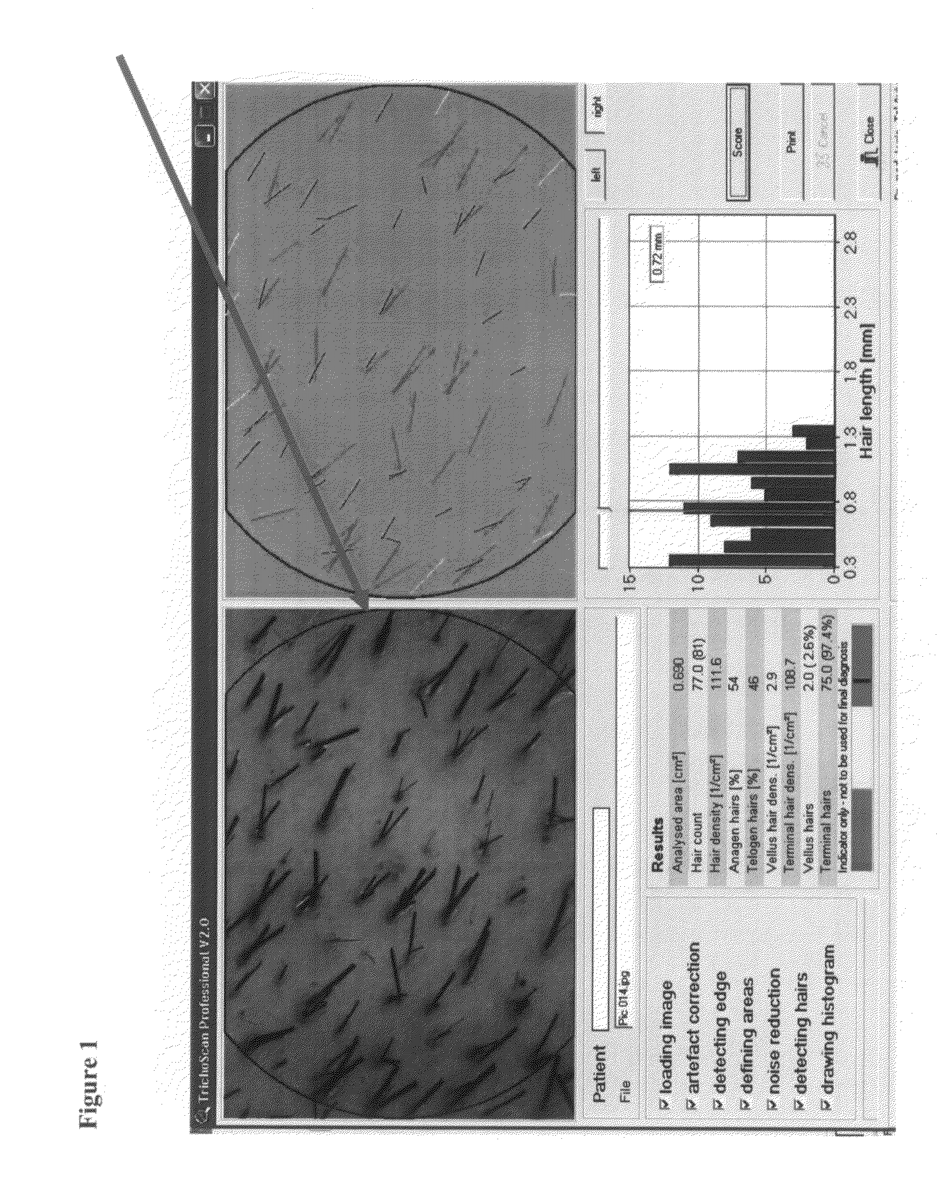 Compositions and Methods for Inducing Hair Growth