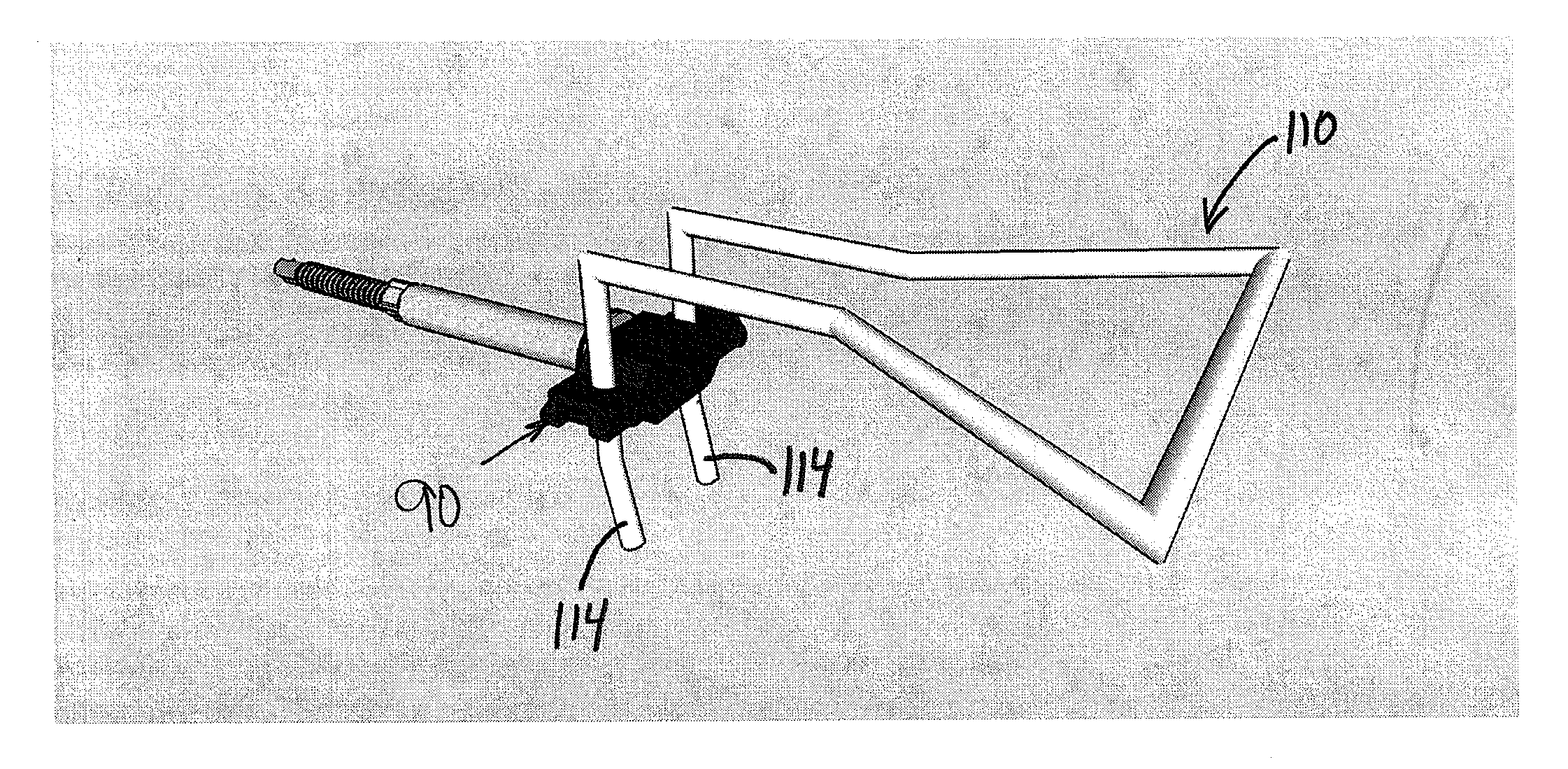 Thermal clip attachment apparatus for masonry anchors and methods thereof