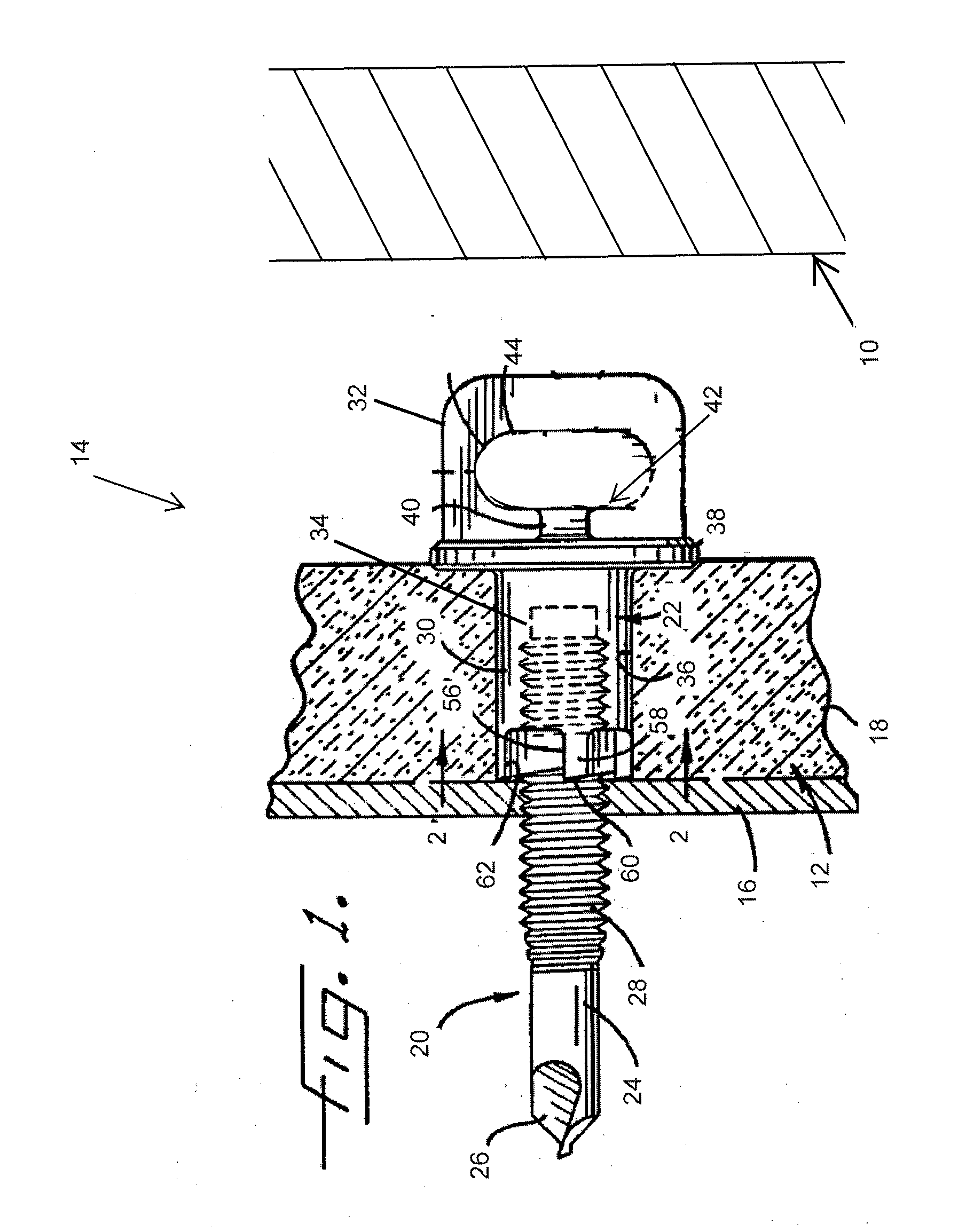 Thermal clip attachment apparatus for masonry anchors and methods thereof