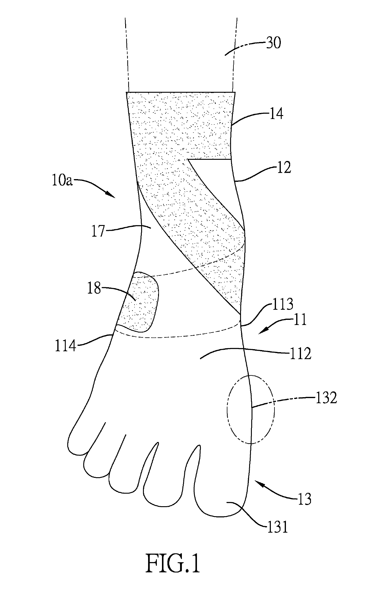 Flat foot orthosis