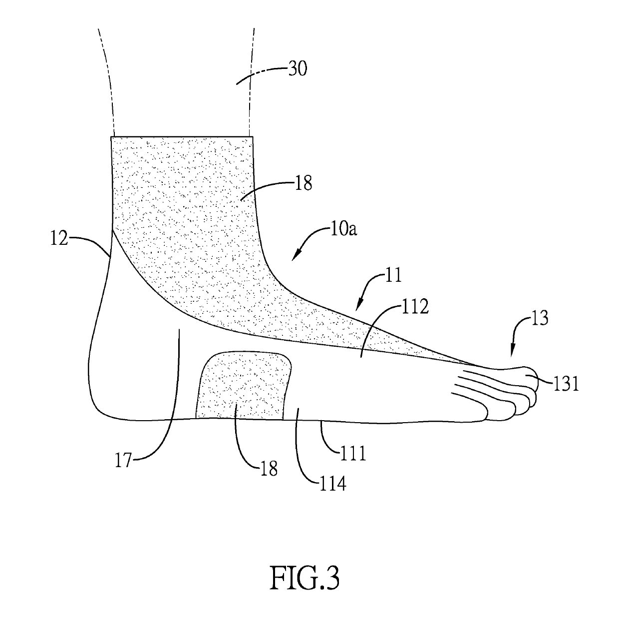 Flat foot orthosis