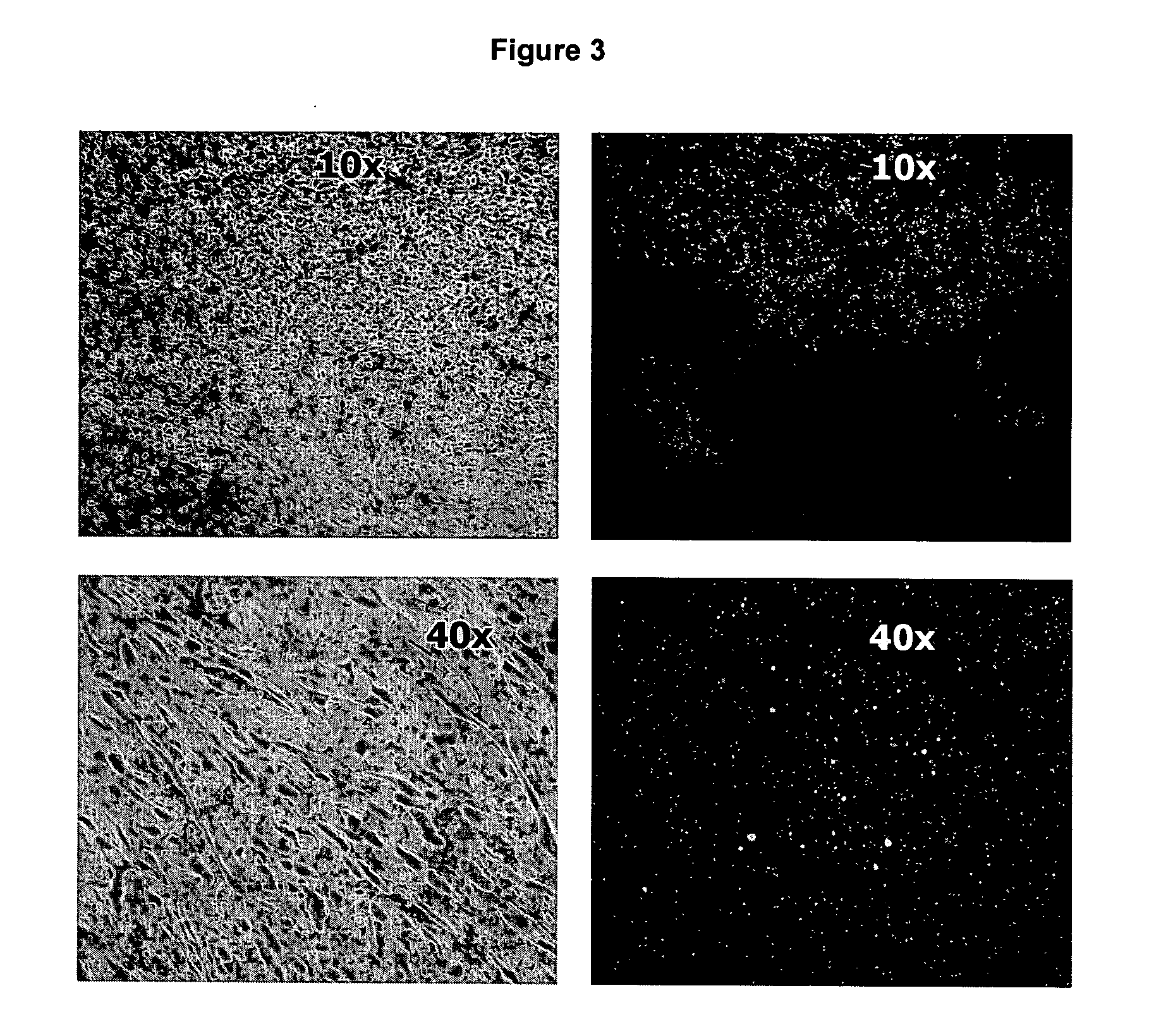 Nucleic acid ligands to complex targets