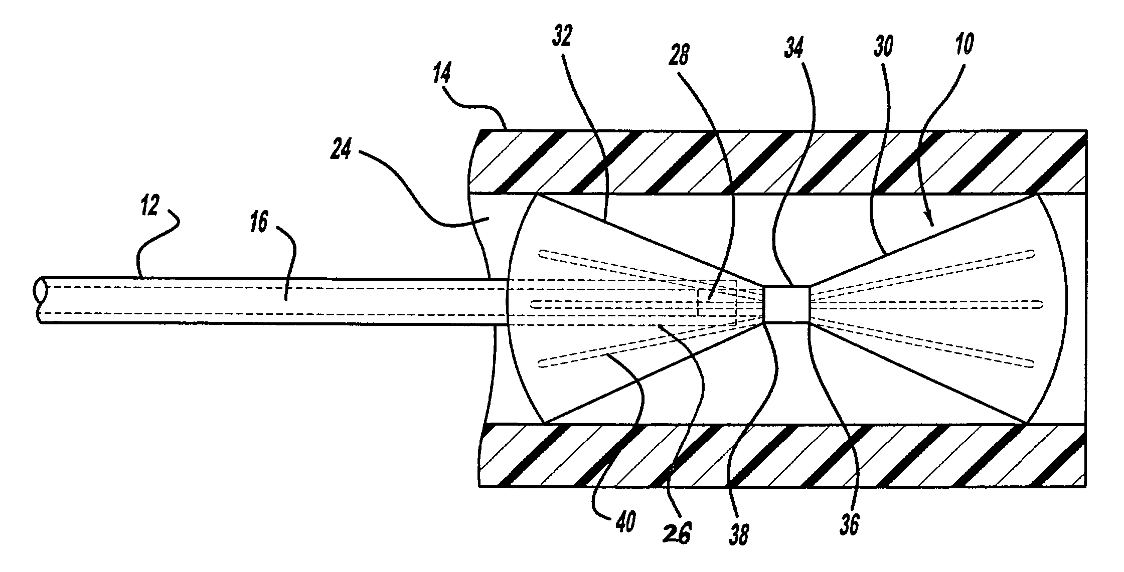 Aneurysm neck cover for sealing an aneurysm