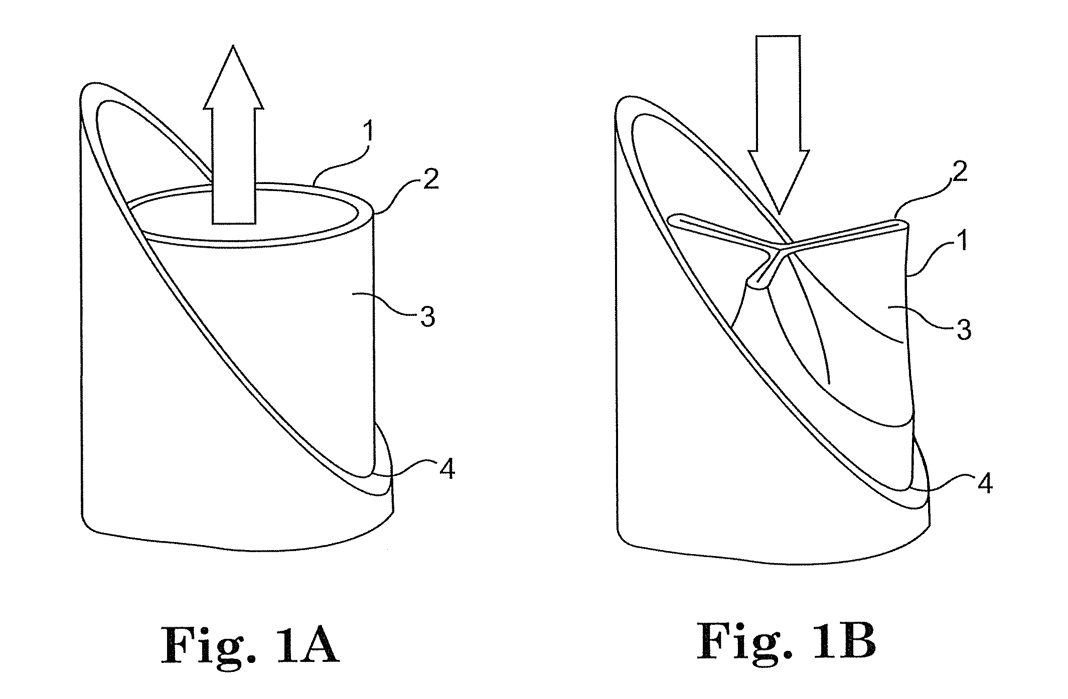 Anchoring structure with concave landing zone