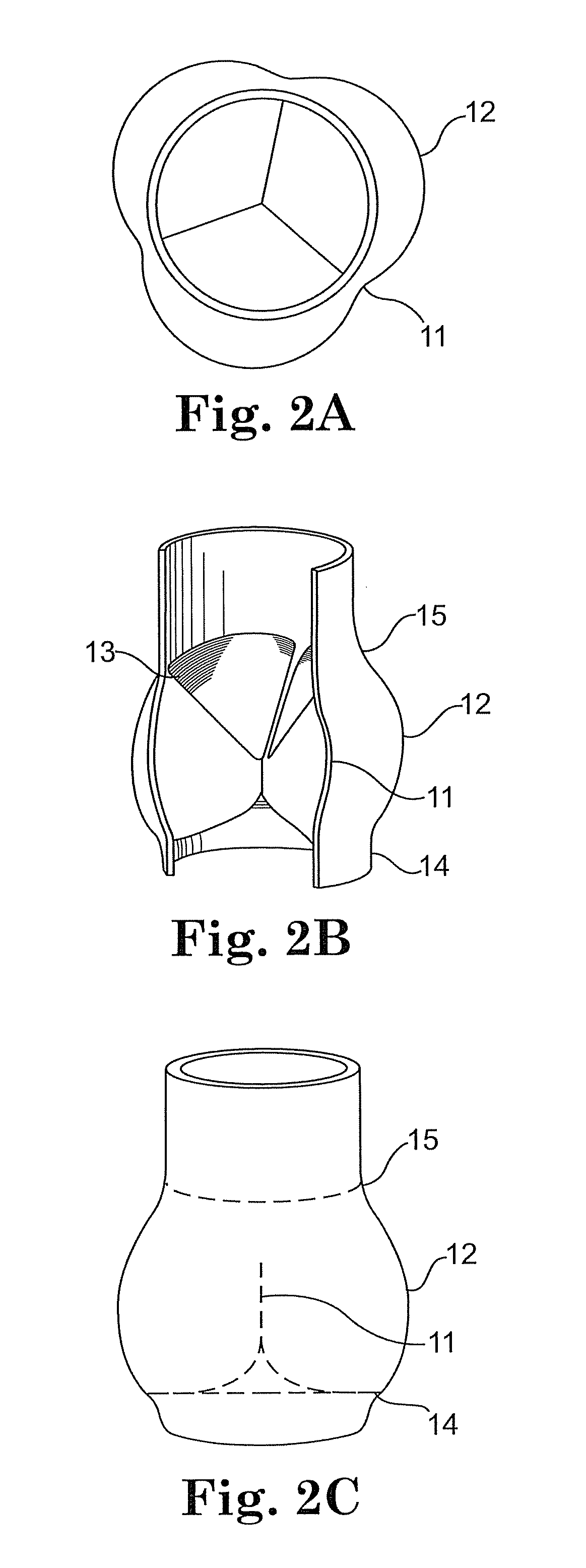 Anchoring structure with concave landing zone