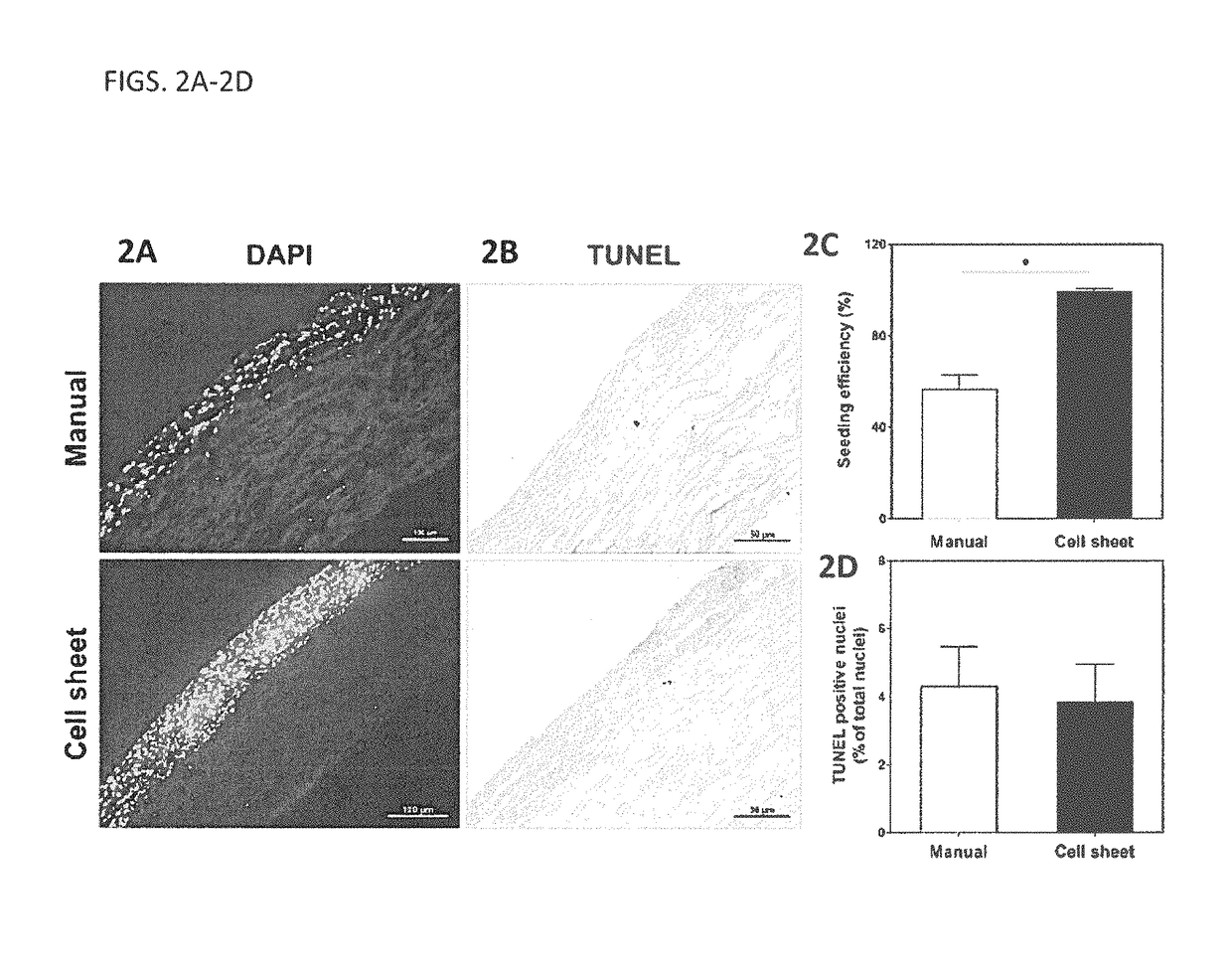 Laminous vascular constructs combining cell sheet engineering and electrospinning technologies