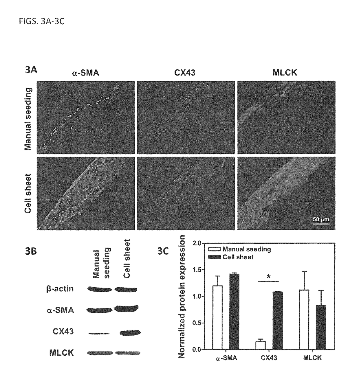 Laminous vascular constructs combining cell sheet engineering and electrospinning technologies