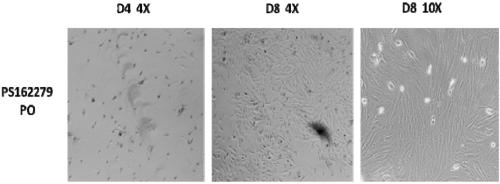 Placental mesenchymal stem cell preparation used for treating premature ovarian failure