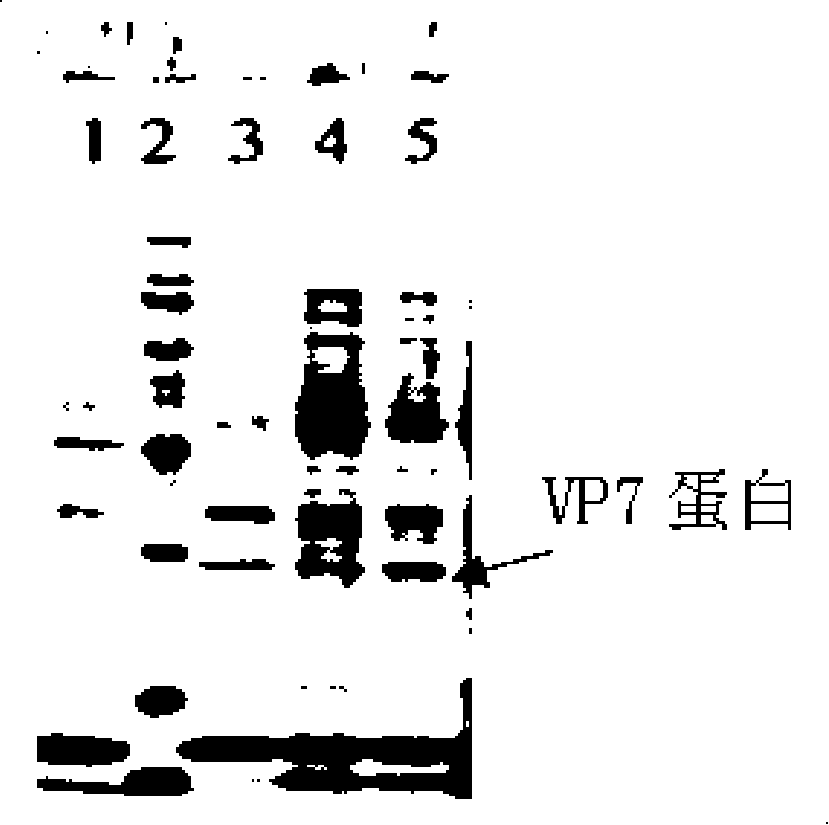 Recombined bifidobacteria -hRV/VP7 expression vector and oral administration vaccine thereof