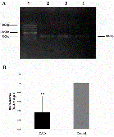 Application of MED6 genes serving as acute myocardial infarction risk prediction marker