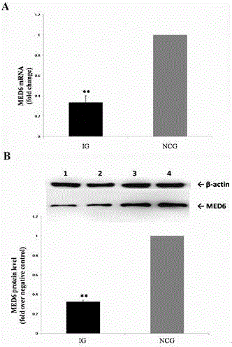 Application of MED6 genes serving as acute myocardial infarction risk prediction marker