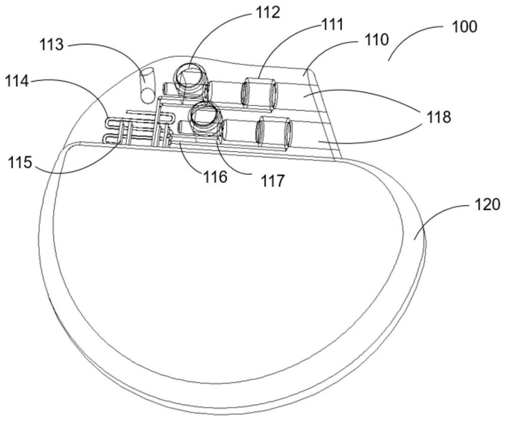 Surgical suture bent hole structure of implantation device and forming method of surgical suture bent hole structure