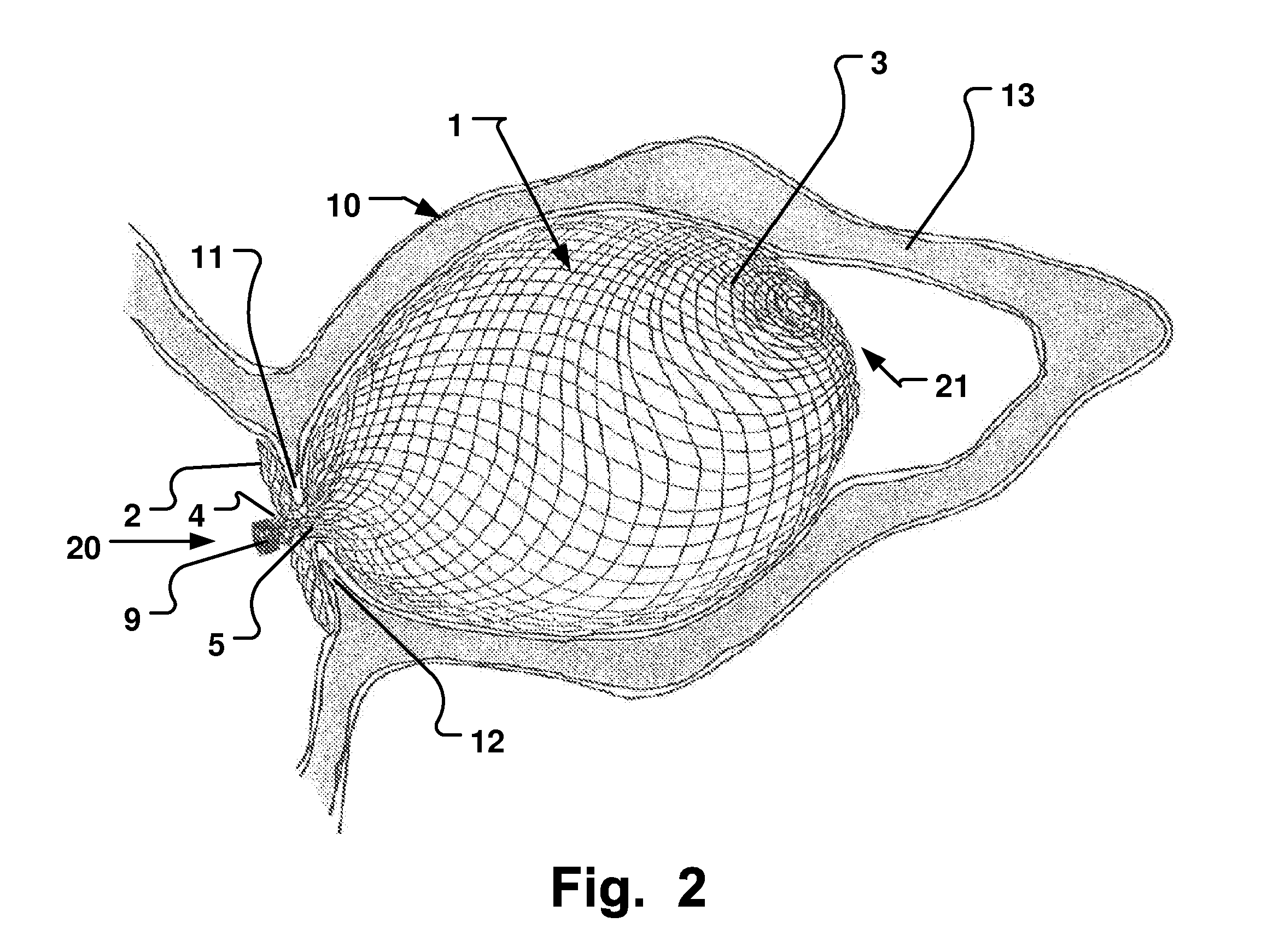 Occluder For Occluding an Atrial Appendage and Production Process Therefor