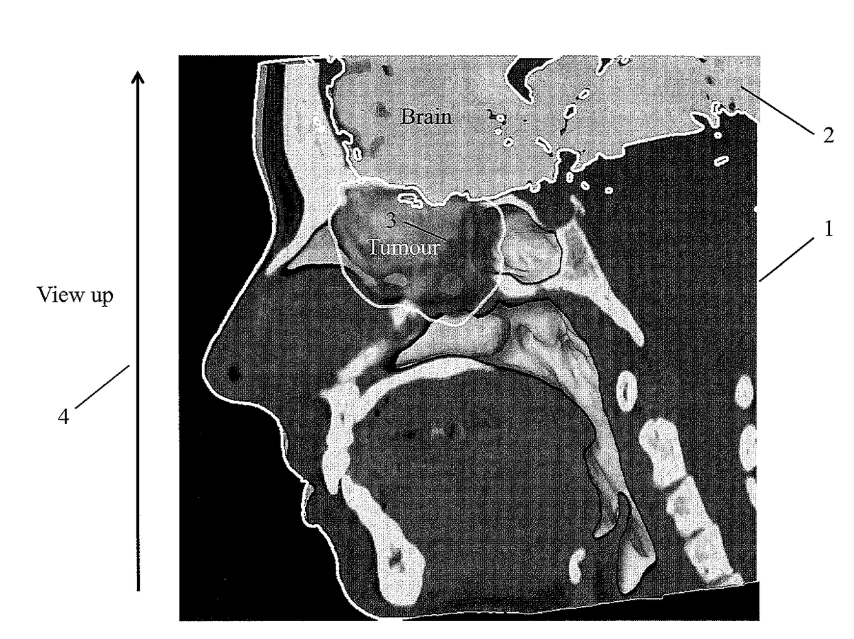 Indication-Dependent Display of a Medical Image