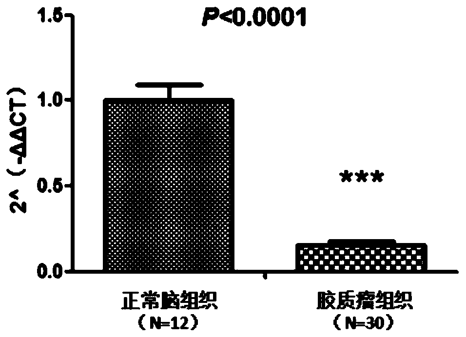 Glioma prognostic marker circ15:101235082|101235577 and its application