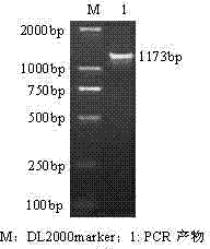 Intramuscular fat deposition SCD (Stearoyl-CoAdesaturase) gene