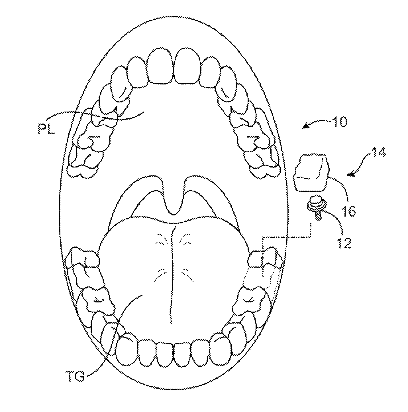 Methods and apparatus for transmitting vibrations