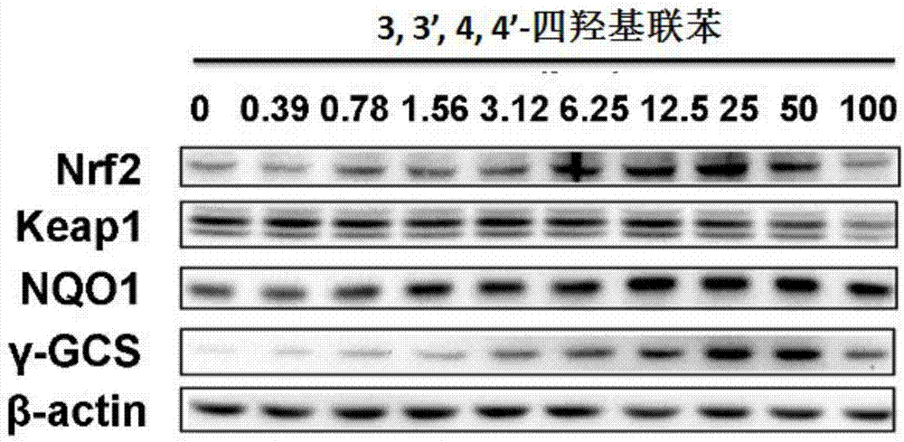 Application of biphenyl compound in preparing medicines for treating oxidative stress induced diseases