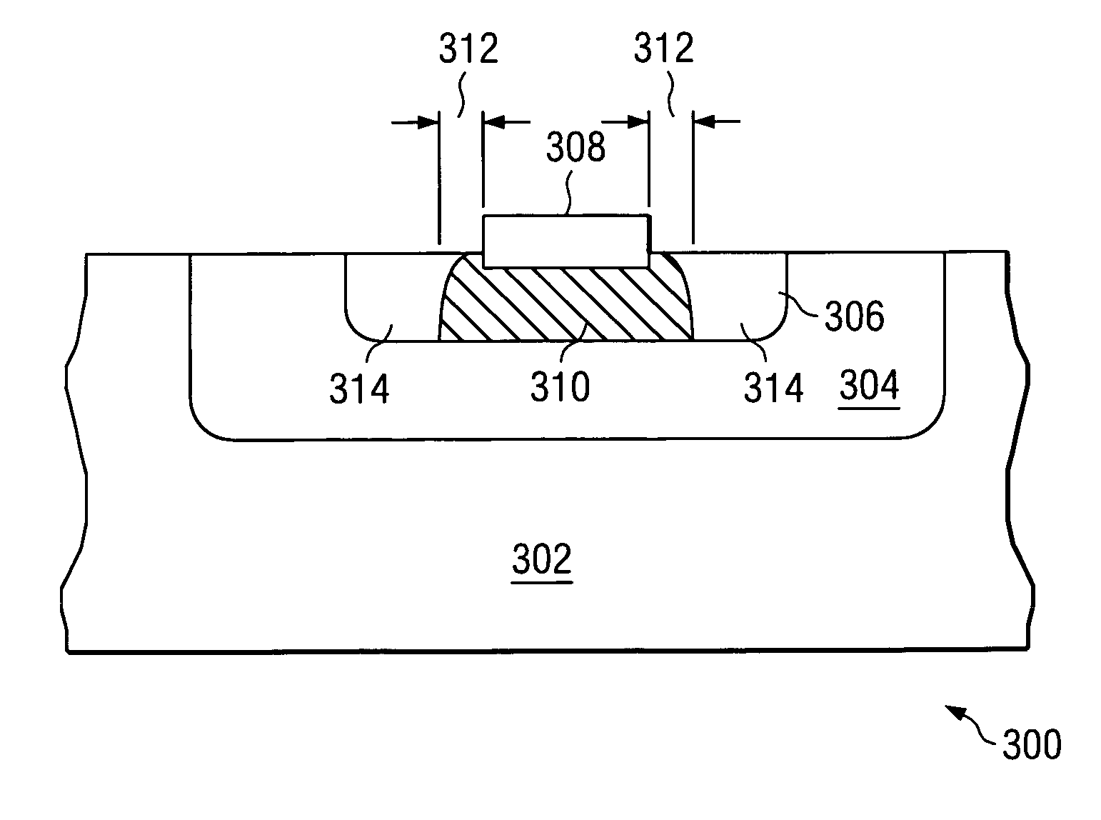 Versatile system for optimizing current gain in bipolar transistor structures