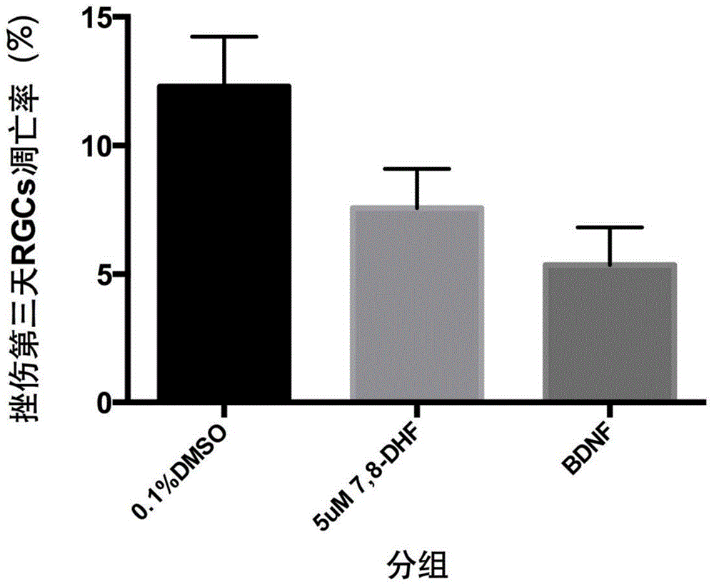 Application of 7,8-dihydroxyflavone (DHF) to preparation of drug for treating retinal degenerative diseases