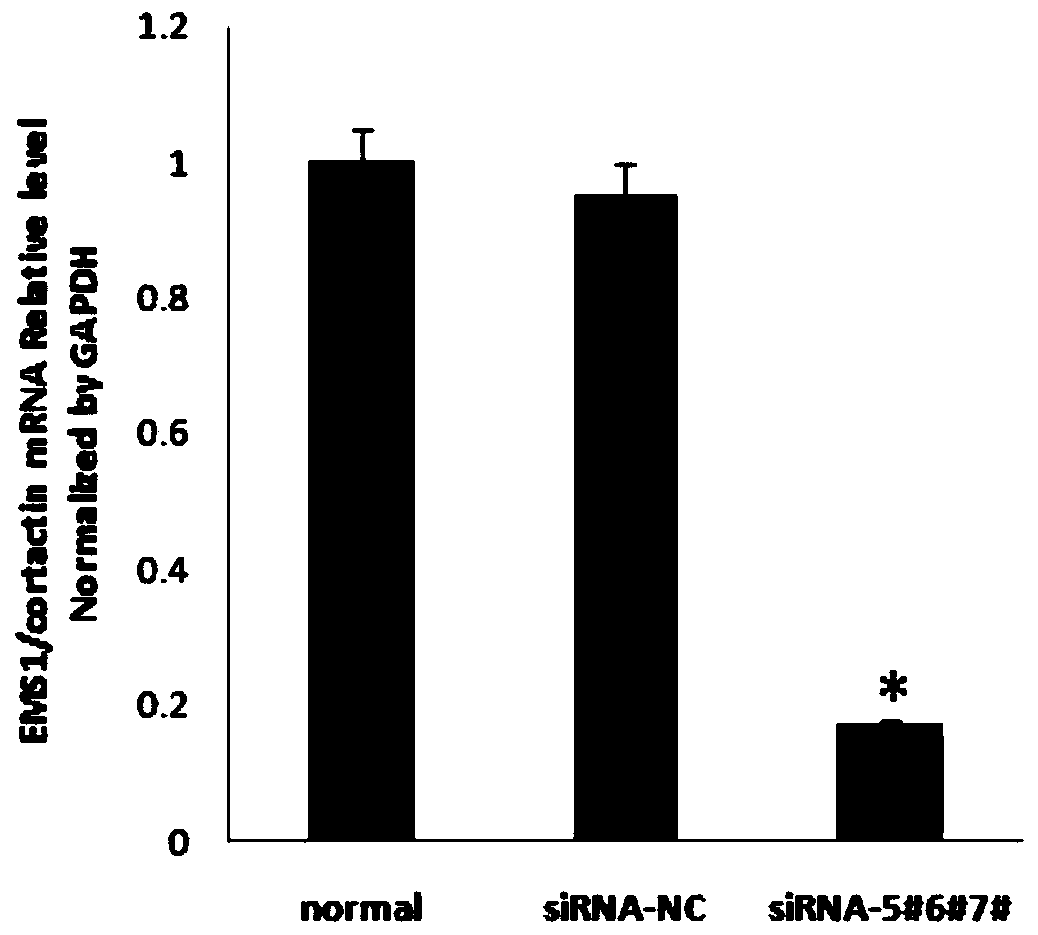 Multi-target siRNA molecule targeting ems1/cortactin and its application