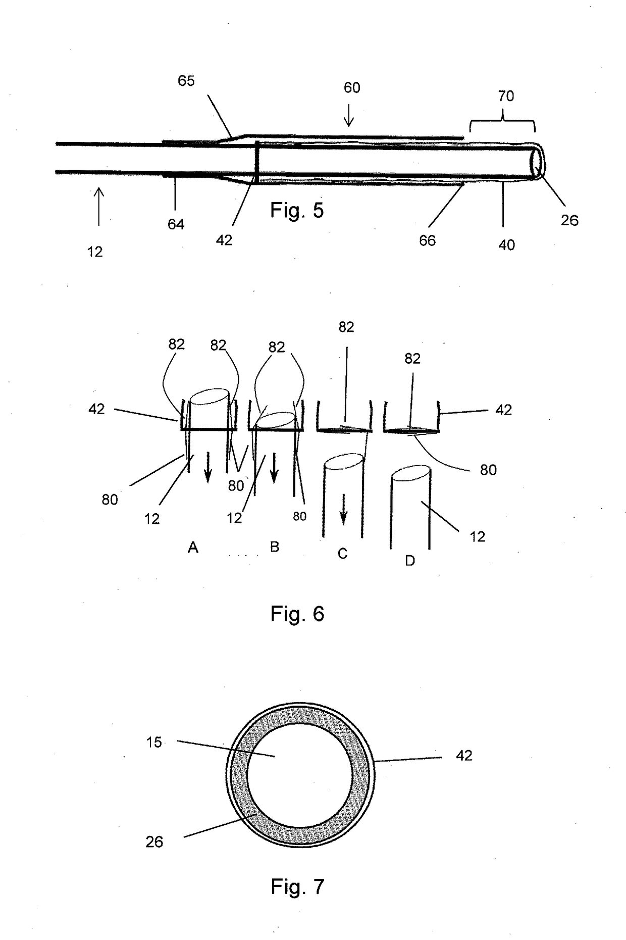 Aneurysm treatment apparatus