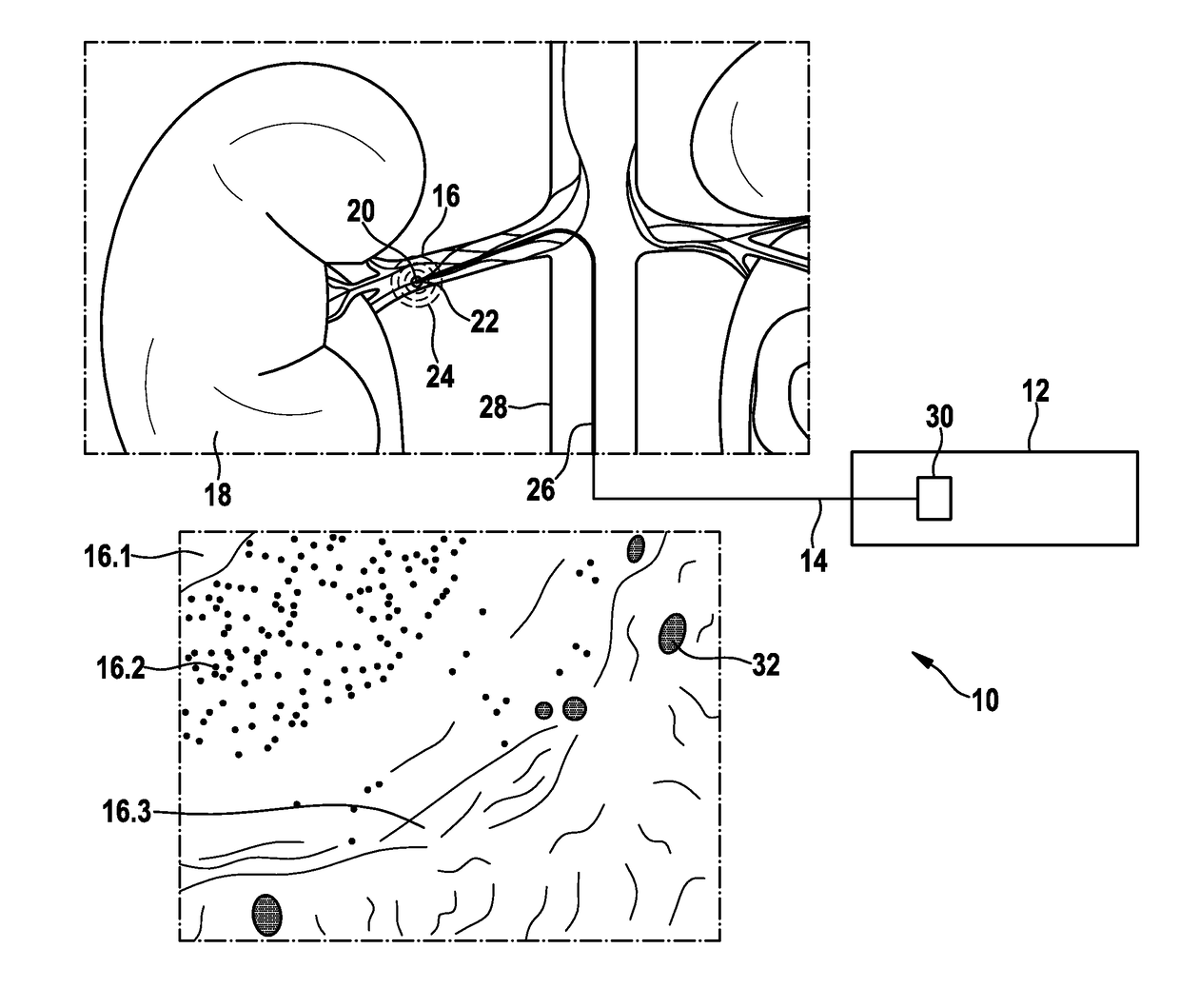 Medical device for evaluating a temperature signal