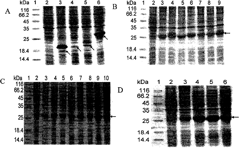 Helicobacter pylori urease B antigenic epitope polypeptide and application thereof