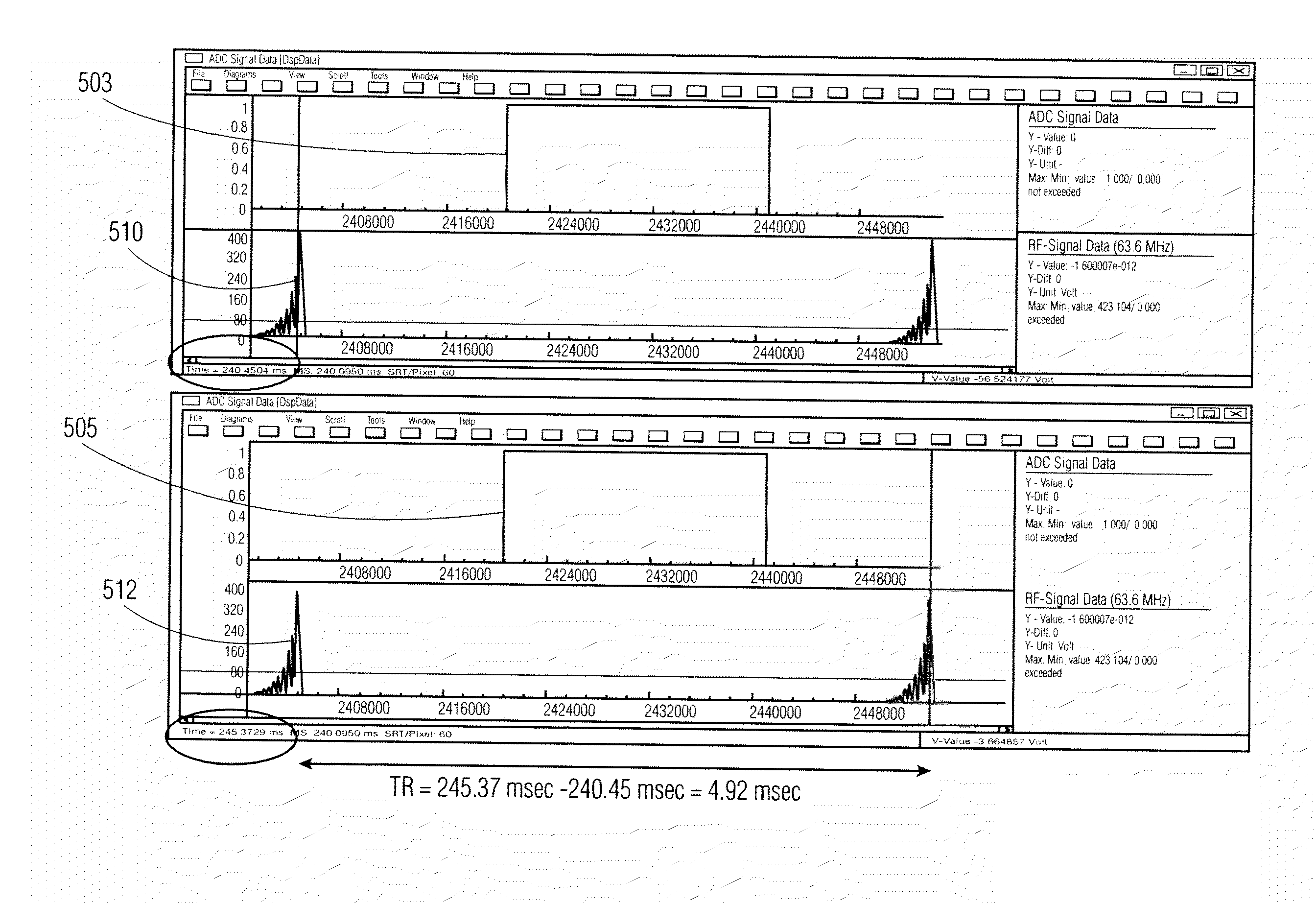 System for Image Acquisition With Fast Magnetic Resonance Gradient Echo Sequences