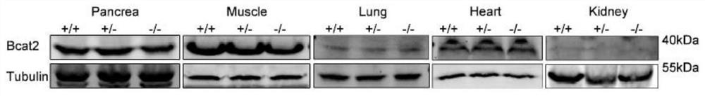 Application of BCAT2 inhibitor in preparation of medicine for preventing and/or treating BCAT2-mediated related metabolic diseases