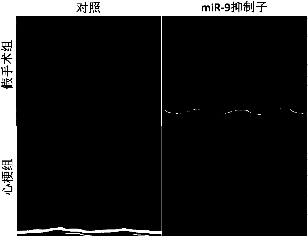 Application of miRNA repressor in preparing drug for preventing and controlling myocardial infarction