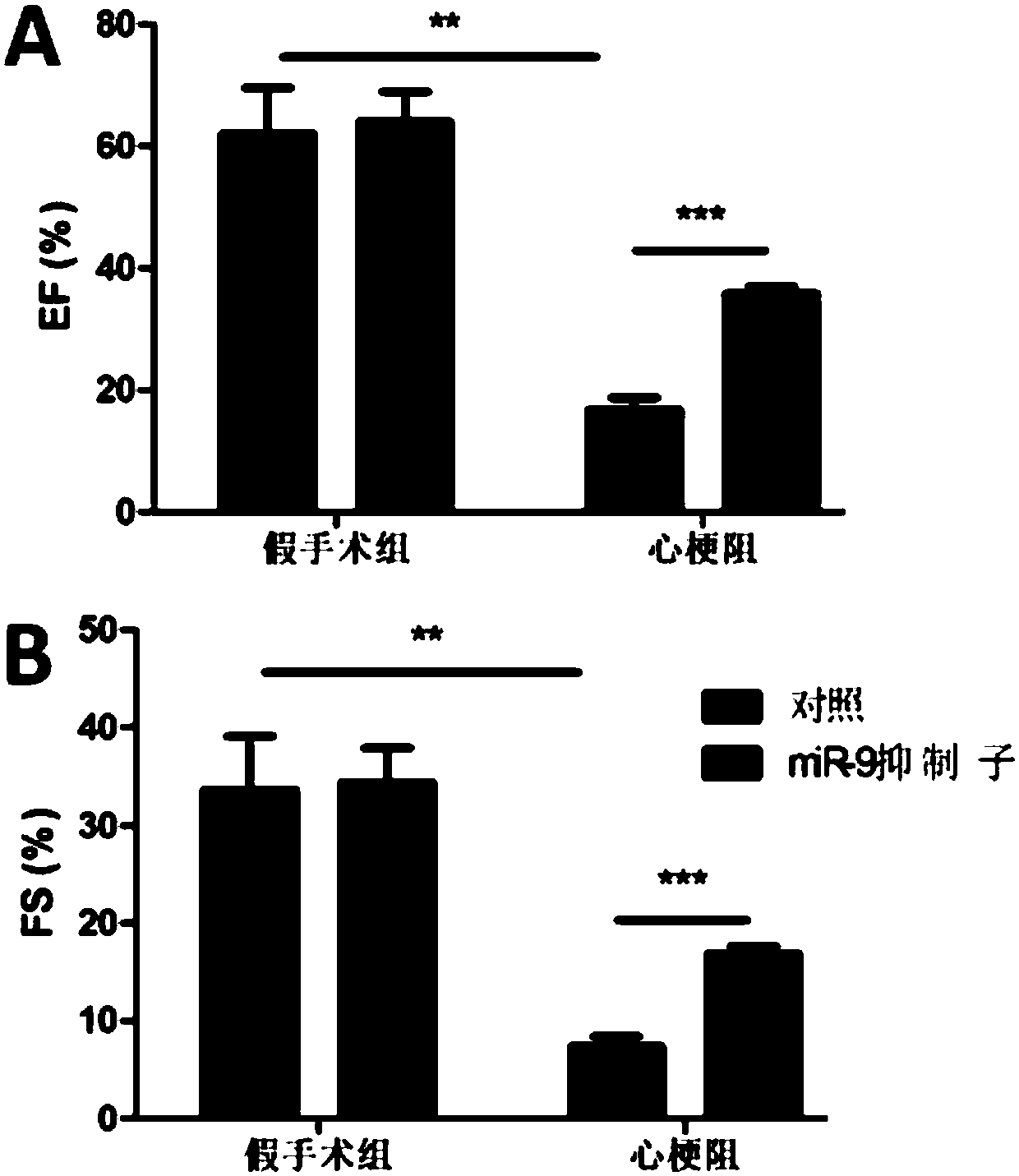 Application of miRNA repressor in preparing drug for preventing and controlling myocardial infarction