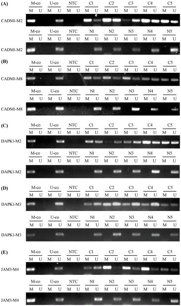 Molecular marker for early screening cervical cancer and detecting primers