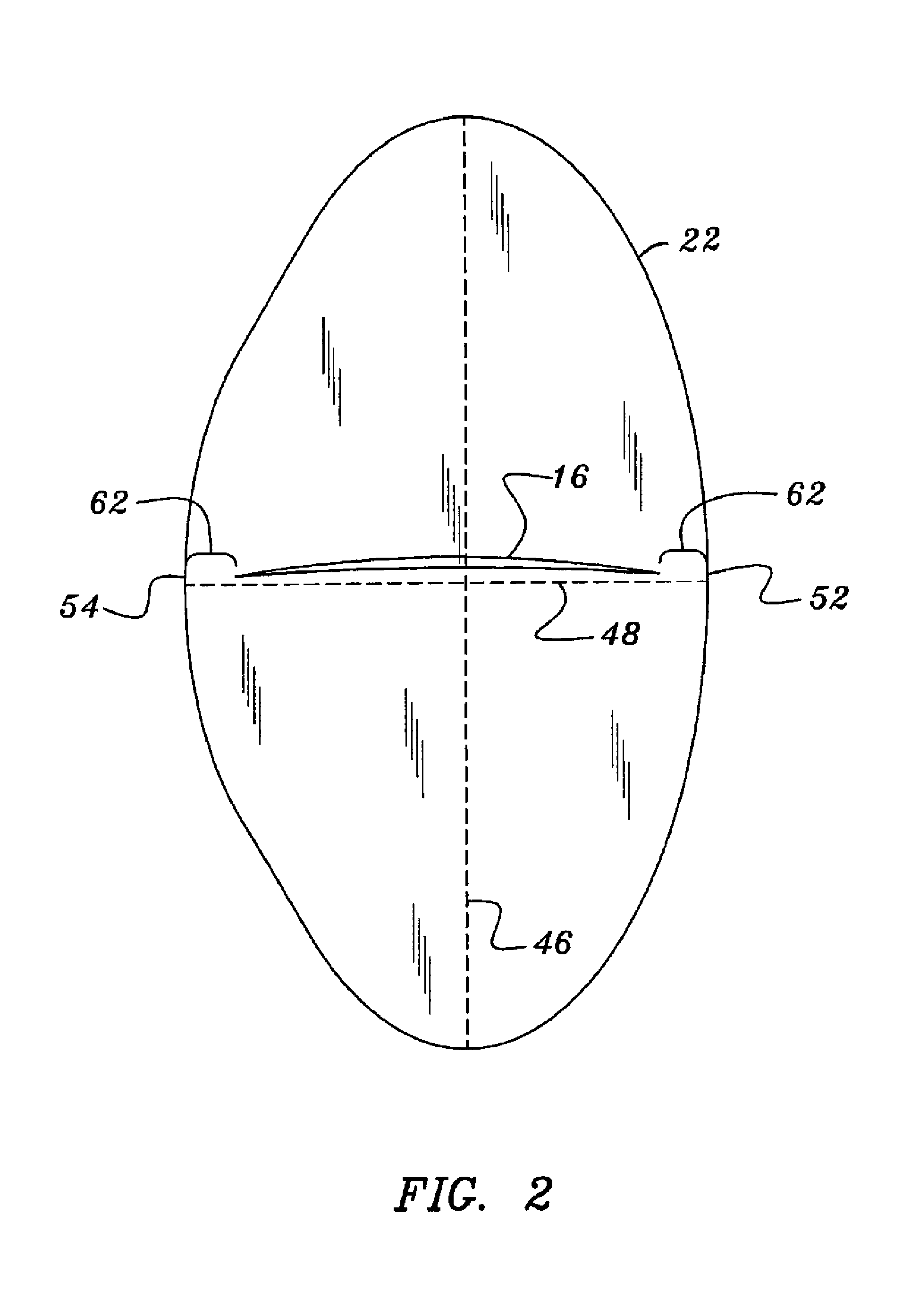 Bicuspid pulmonary heart valve and method for making same