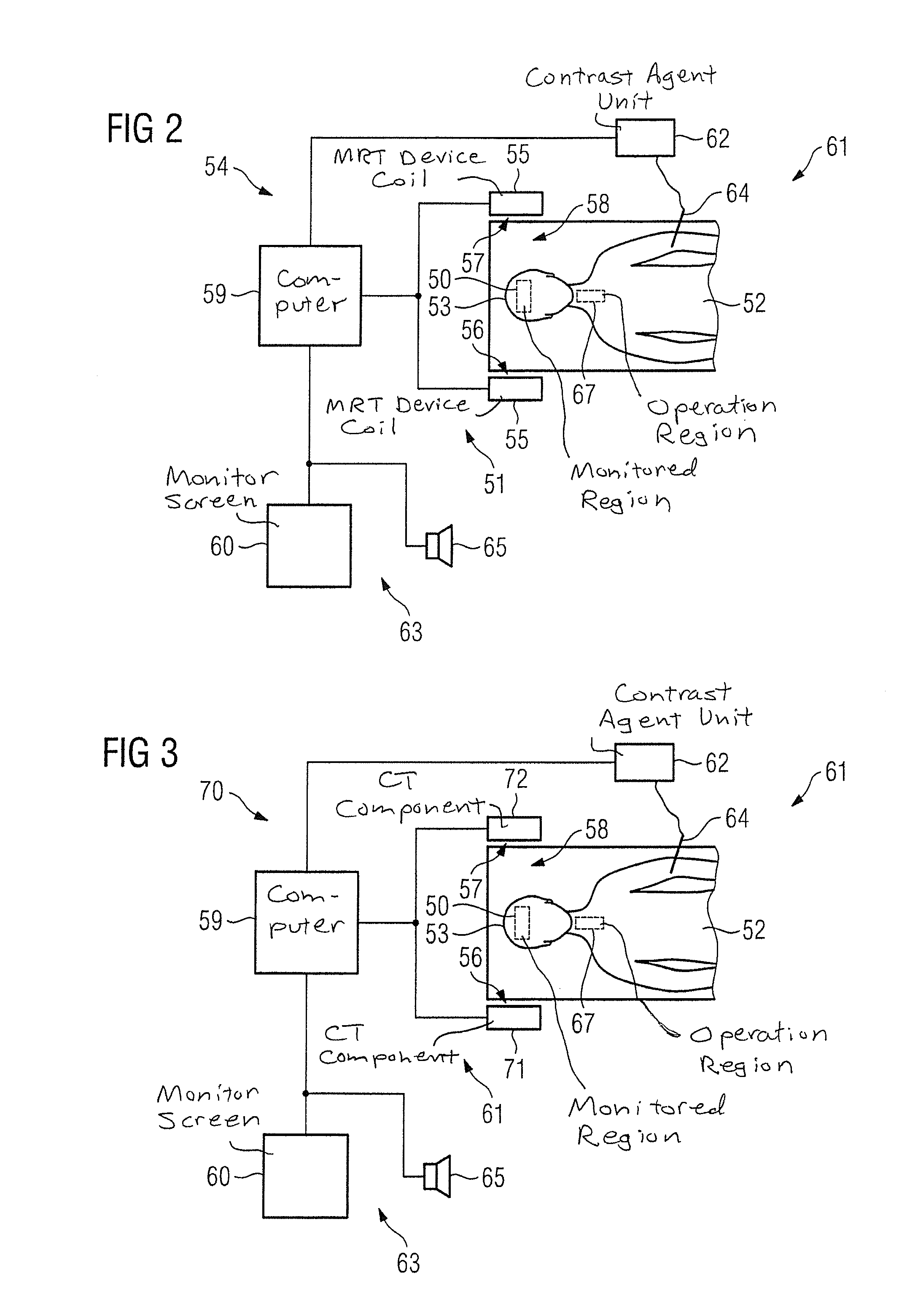 Method and device for monitoring a medical procedure such as a vascular surgery operation