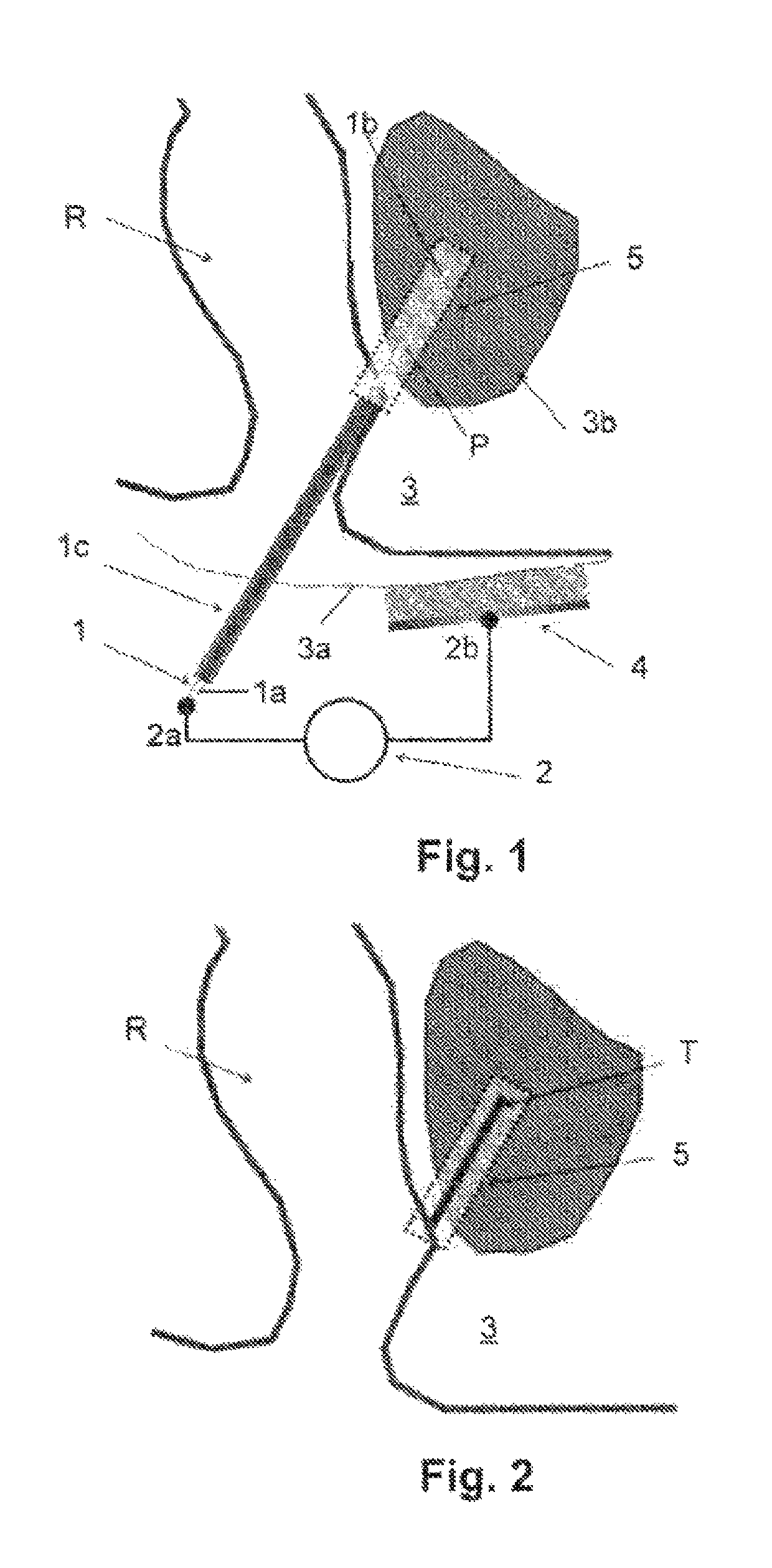 System for preventing bacterial infections in needle trajectories