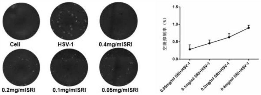 Application of sophoridine in preparation of anti-herpes virus medicine