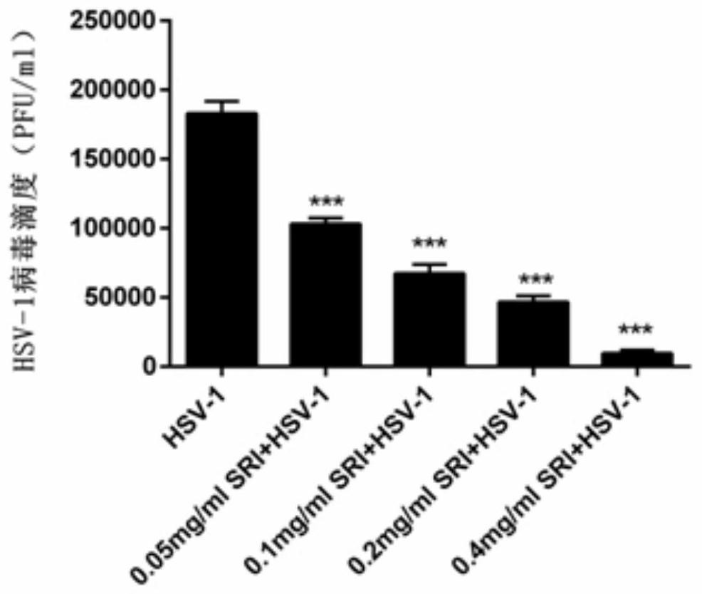 Application of sophoridine in preparation of anti-herpes virus medicine