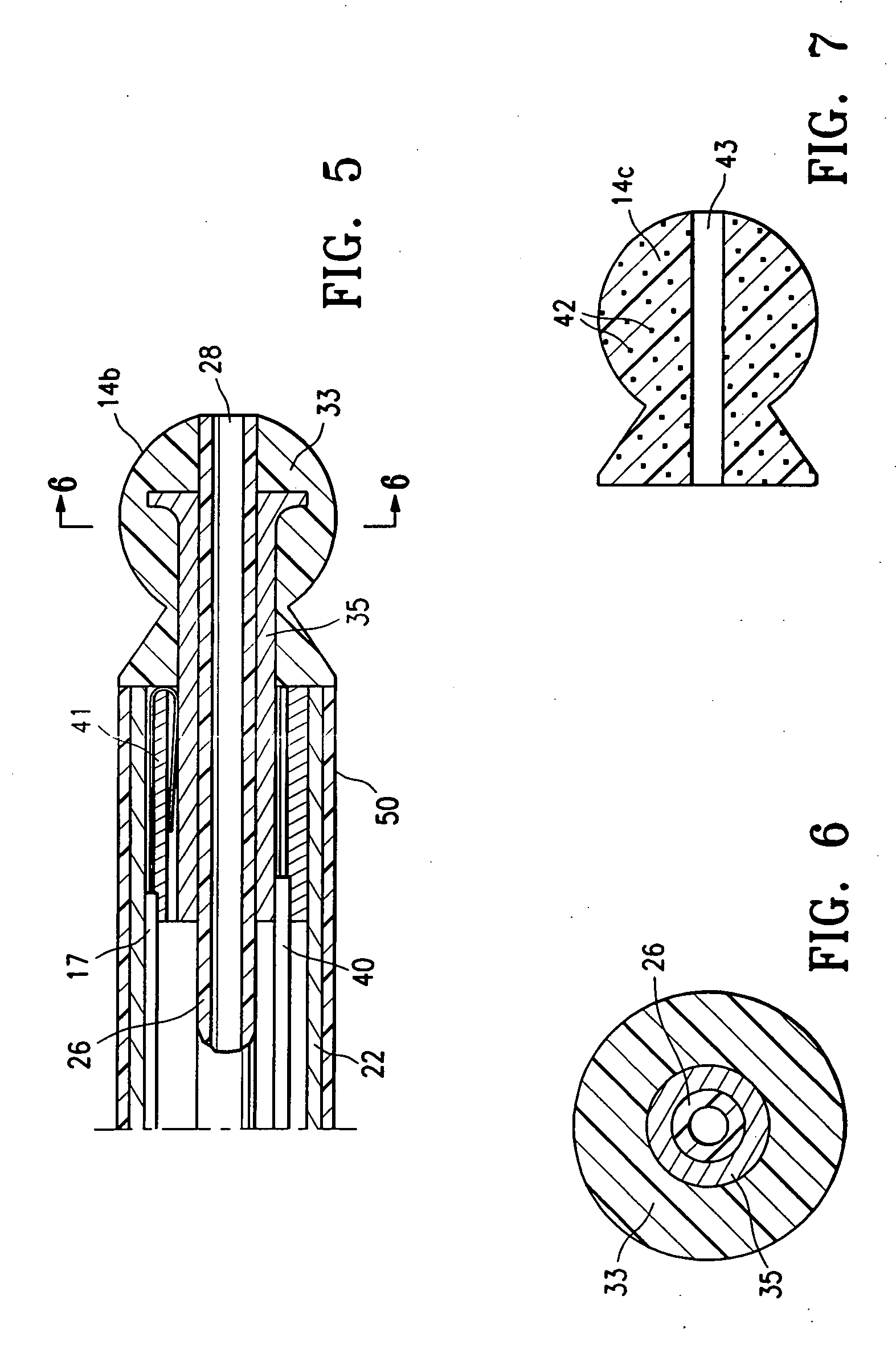 Echogenic needle catheter configured to produce an improved ultrasound image